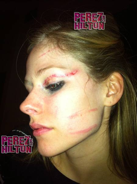 Avril Lavigne tras la agresión | PerezHilton.com