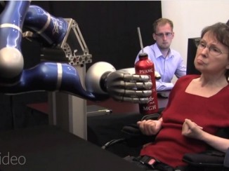 Mujer paralítica mueve brazo artificial sólo con su mente