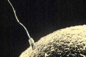 Imagen:Espermatozoide