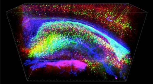 Los científicos usaron hidrogel para remover los lípidos en el cerebro, volviéndolos transparentes | Stanford University