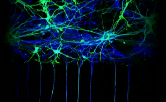 La “cruel belleza” de las enfermedades bajo el microscopio