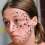 Famosa joven que se tatuó 56 estrellas en el rostro demora tres años en borrarlas