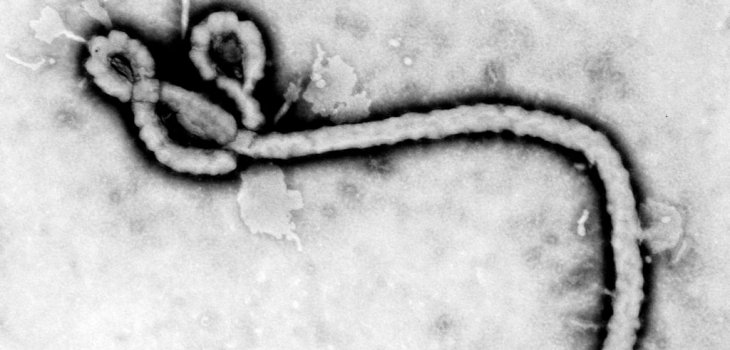 Virus del ébola | Science Magazine