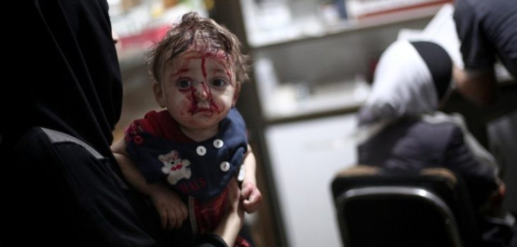 Bebé herido por la guerra en Siria.