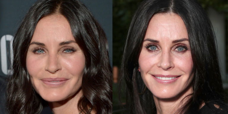 Antes y después de la actriz