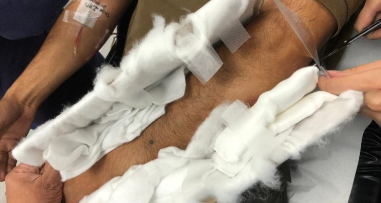 Imágenes muestran graves heridas recibidas por carabinero durante enfrentamientos en Plaza Maipú