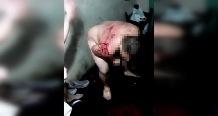 Interno de Santiago 1 fue torturado por otros reos en venganza por asesinato