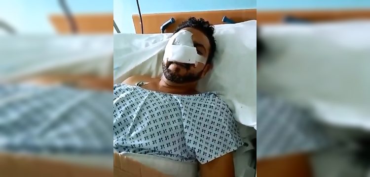 Denuncian que hombre perdió un ojo tras recibir lacrimógena en la cara en Santiago