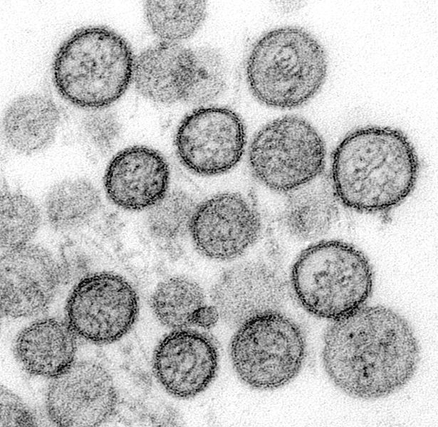 Hanta Virus | Wikipedia