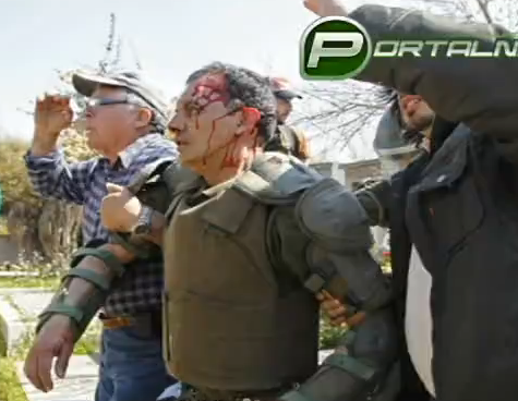 Agresión a carabinero | Portalnet