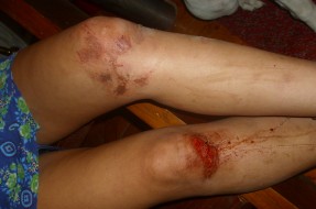 Agresión | Jóvenes afectadas