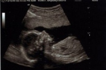 Contexto | Daniel Lobo en Flickr (CC)