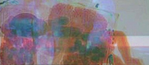 Rayos X | 20minutos.es