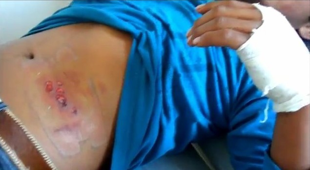 Menor mapuche herido