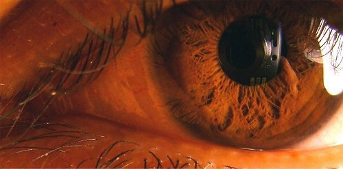 Archivo | Gerson Guzmán (BBCL)