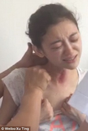 Joven actriz china muere tras intentar combatir el cáncer con medicina alternativa