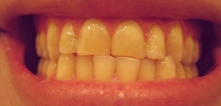 DRosenbach | Flickr (cc)