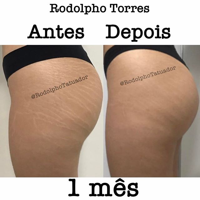 Rodolpho Torres