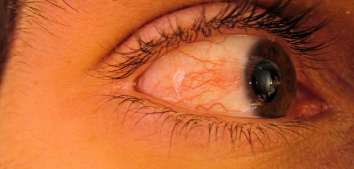 Stefanos Kofopoulos (CC) Flickr