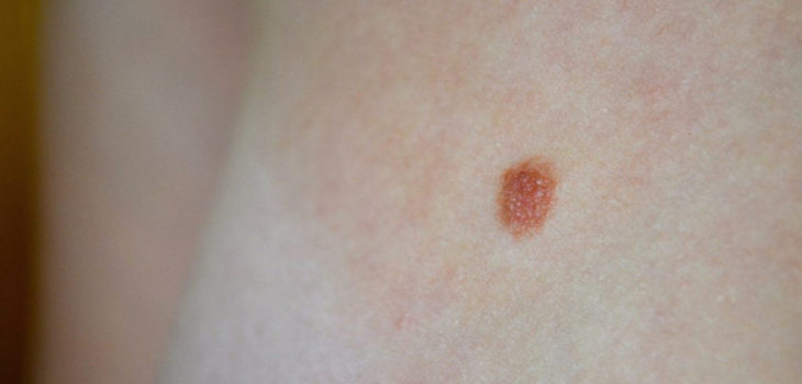 Thebusstopworld (CC) Flickr 