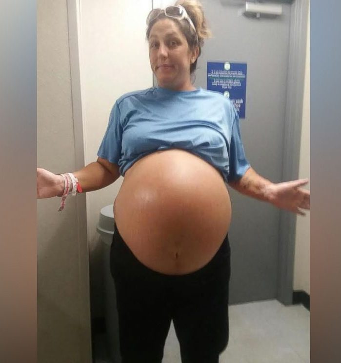 Mujer Da A Luz A Enorme Bebe Que Peso Mas De 6 Kilos En Su Nacimiento Mujer Biobiochile