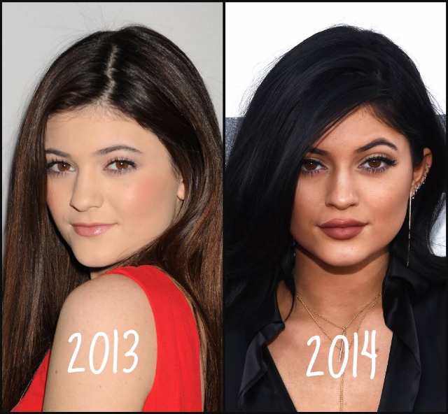 Antes y después de Kylie 