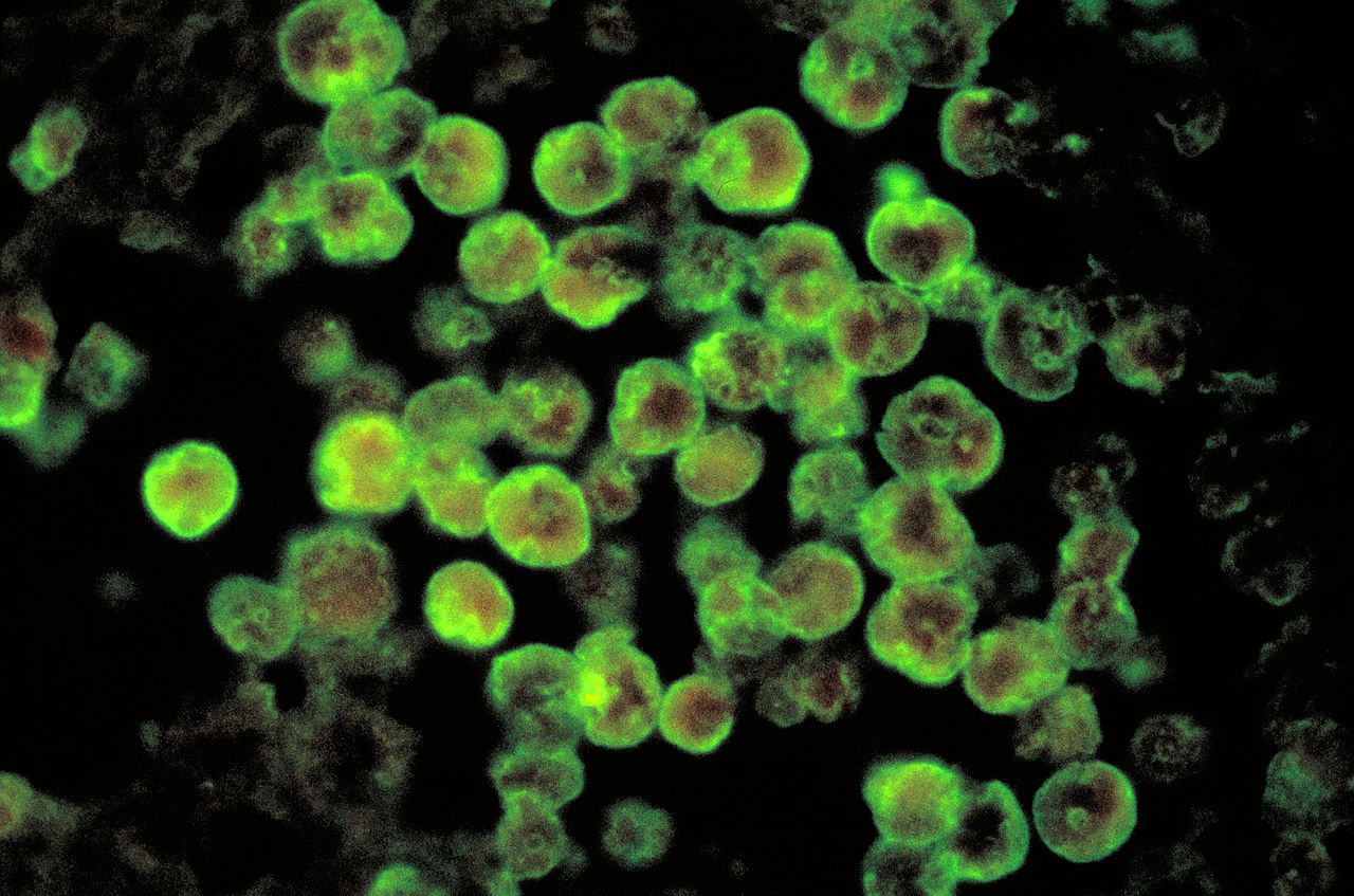 Imagen al microscopio de la ameba (CC) Wikimedia Commons