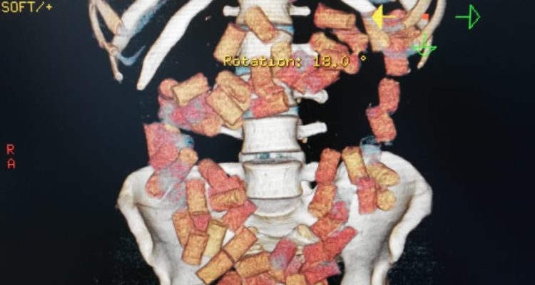 Cedida | radiografia en 3D