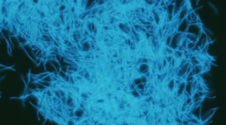 Hiroyuki Imachi | Eurek Alert