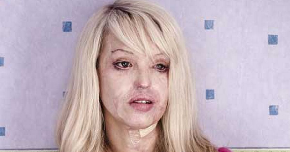 Katie Piper