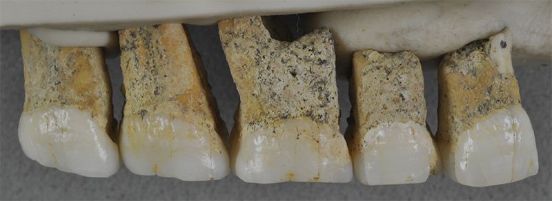 dientes-de-homo-luzonensis.jpg