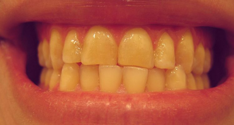 DRosenbach | Flickr (cc)
