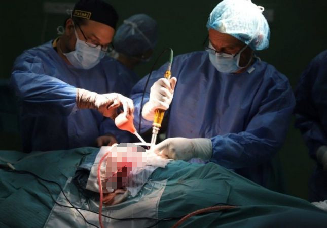 Dos de los cirujanos en la operación | CaKA