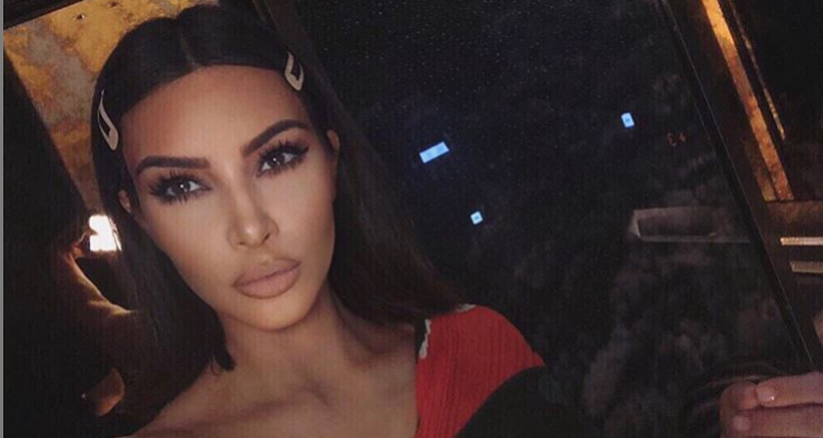  La lucha de Kim Kardashian contra la psoriasis  mostró foto sin maquillaje con marcas de enfermedad