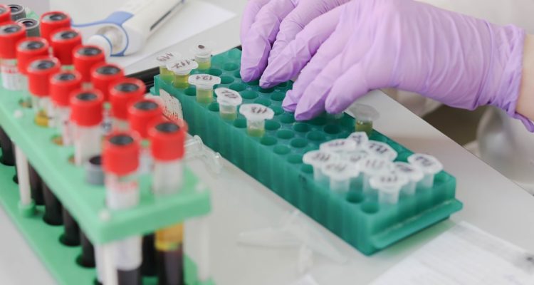 Belova59 | Pixabay (cc0)