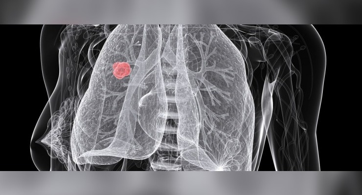 Oregon State University (CC) Flickr