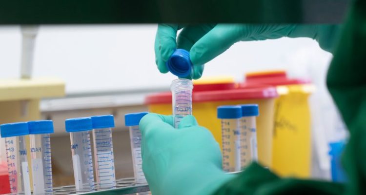 CONTEXTO | Thomas Kienzle | Agence France-Presse