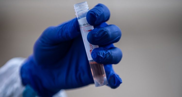 Contexto | Philip Fong | AFP)