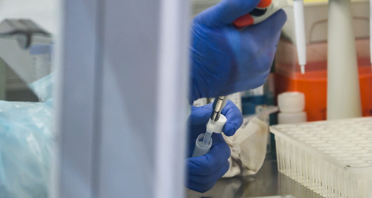 ARCHIVO | Miguel Moya | Agencia UNO