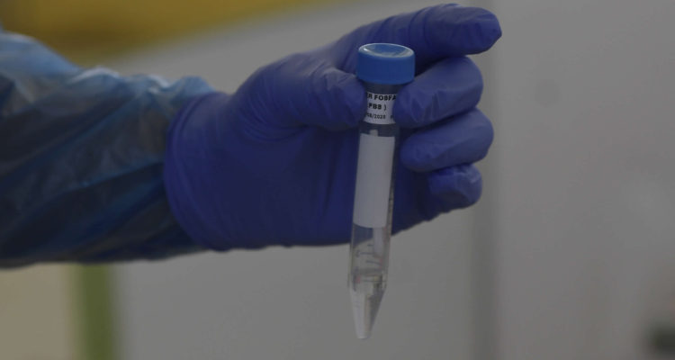 CONTEXTO | Agencia UNO