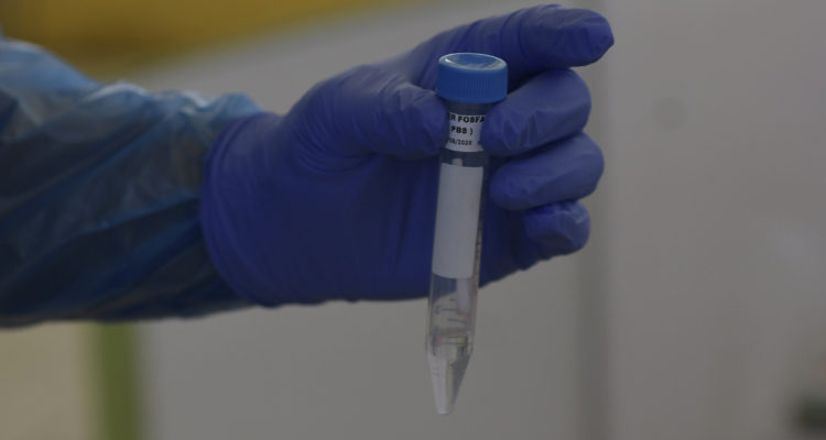 CONTEXTO | Agencia UNO