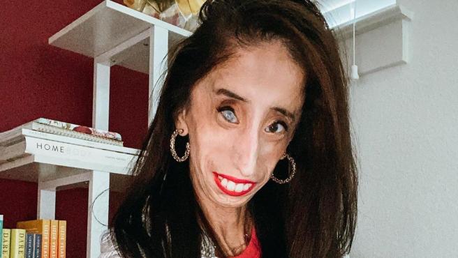 Lizzie Velasquez
