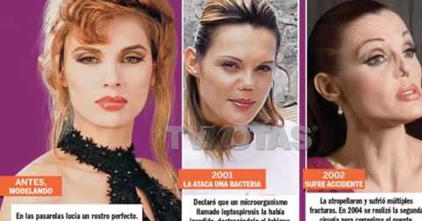 El accidente que destrozó la nariz de modelo mexicana y ni cirujanos de  Botched han podido reparar | TV y Espectáculo | BioBioChile