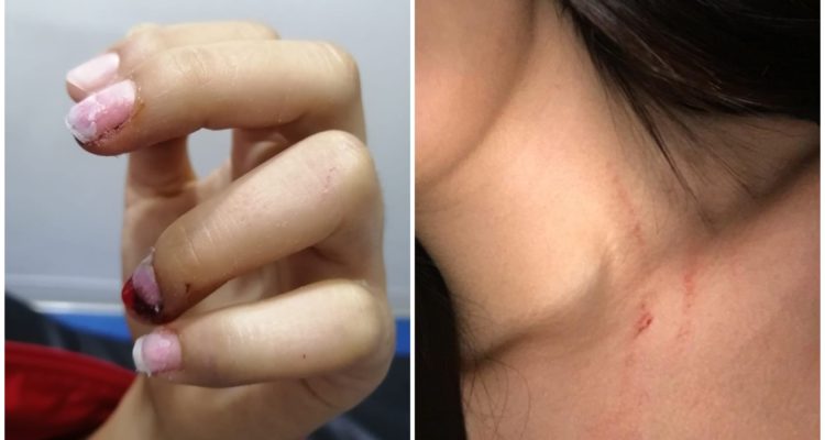 Cedida a Biobiochile