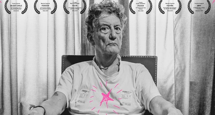 Álvaro: Rockstar don´t wet the bed, Jorge Catoni (c)