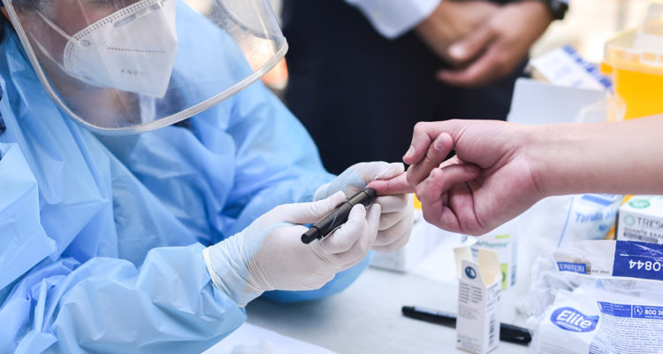 Estudio de Seroprevalencia