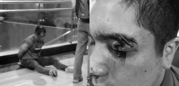 A la izquierda, el pasajero | A la derecha, uno de los guardias heridos