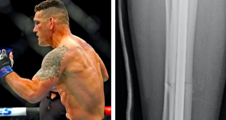Chris Weidman
