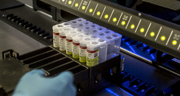 Fernando Lavoz | Agencia UNO