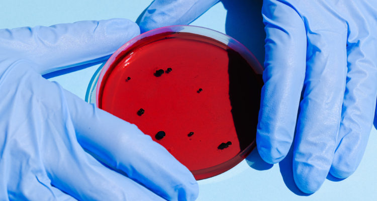 Anna Shvets | Pexels (CCO)